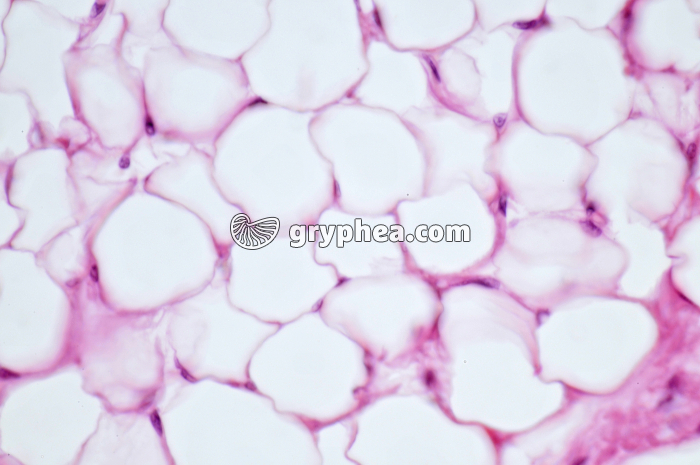 Tissu adipeux CT x160 - gryphea.org